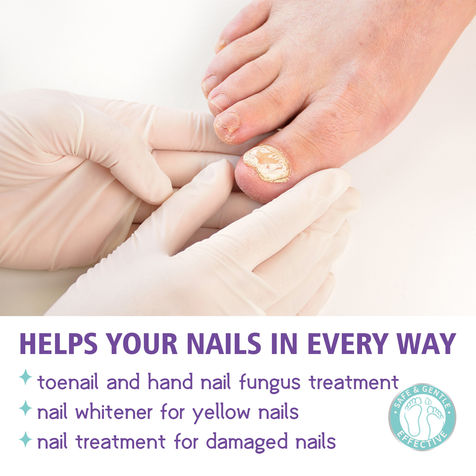 عرض 2 قطعة من NAIL FANGUS SPRAY