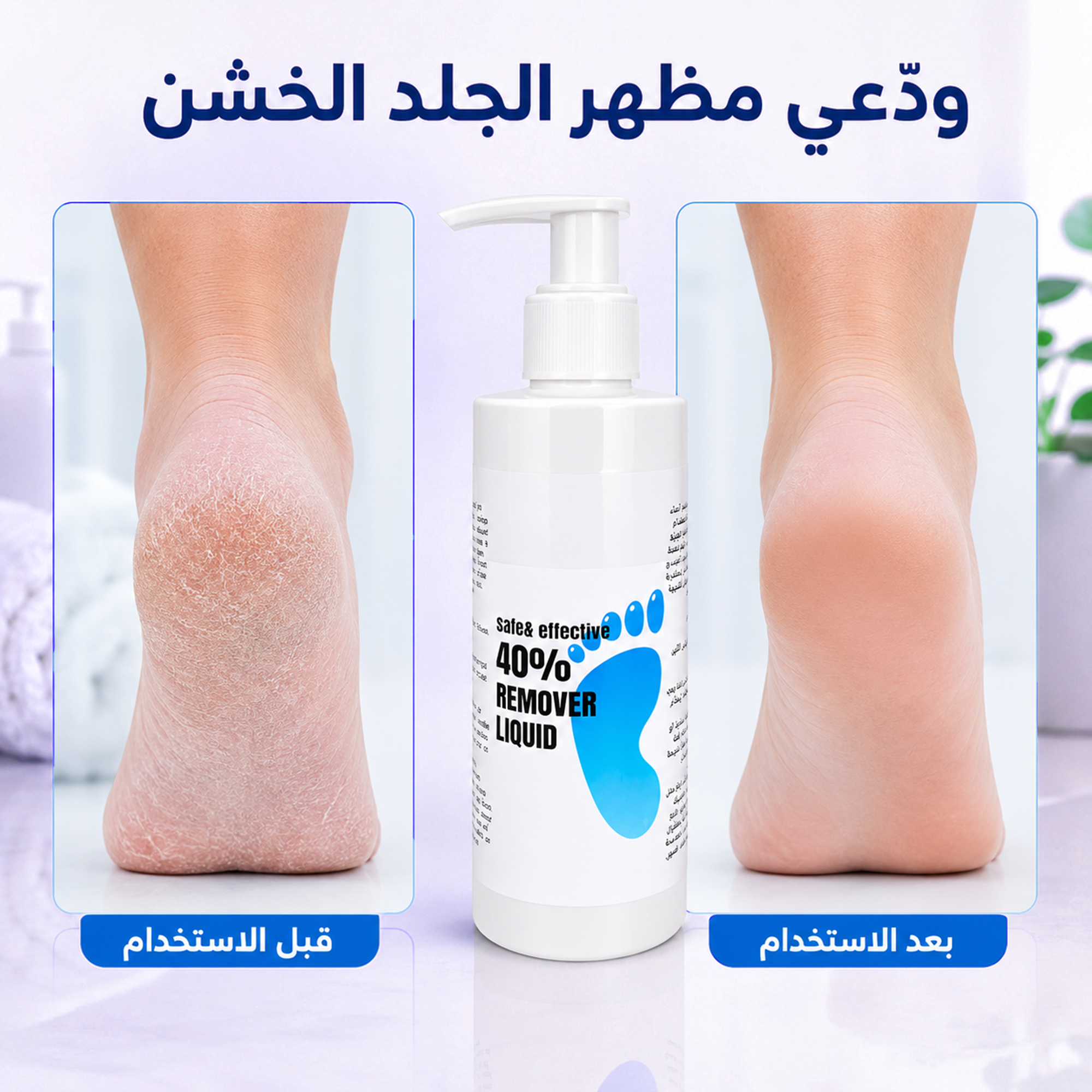 جل مزيل الجلد الميت والكالو 250مل