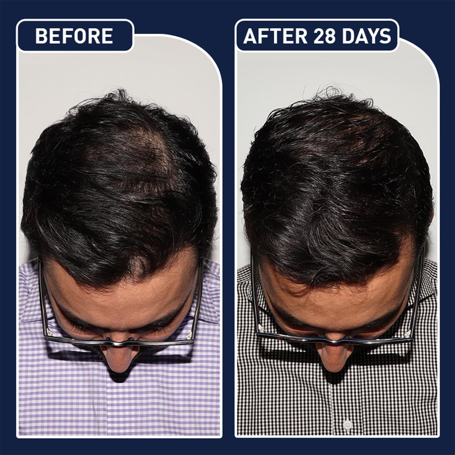 عرض سيرم Blue PePtide + سبراي الشعر FEG 
