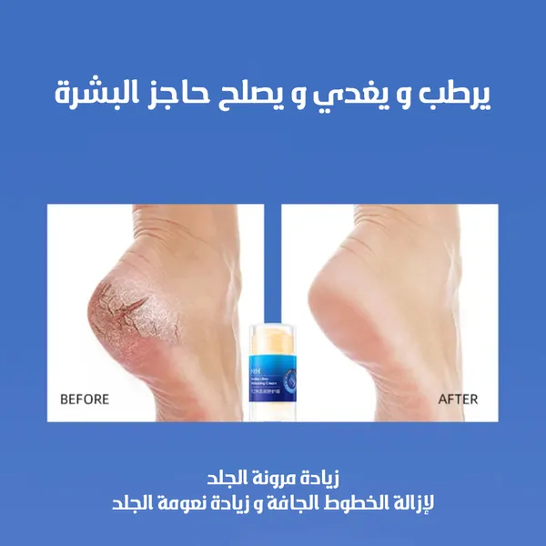 عرض 4 ستيك مرطب لليدين والقدمين- أزرق