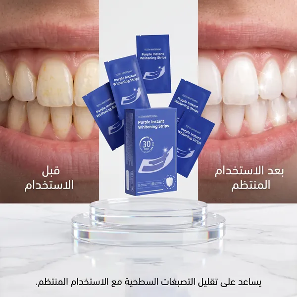 شرائط تبييض الأسنان V34 - أربعة عشر قطعة