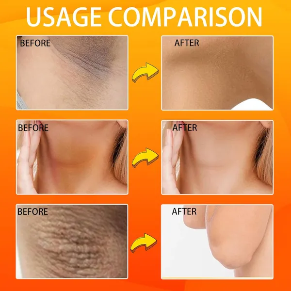 • صابون حمض الكوجيك الكوري