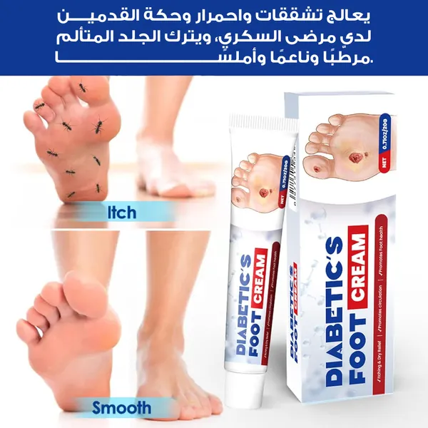 دهان فعال لعلاج قرح القدم السكري - 20 جرام