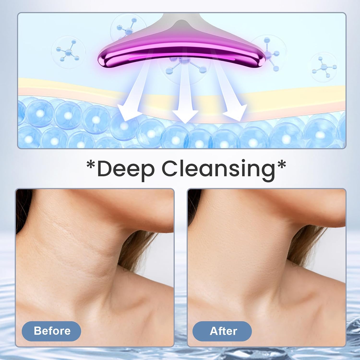 جهاز شد الوجه و ازالة التجاعيد