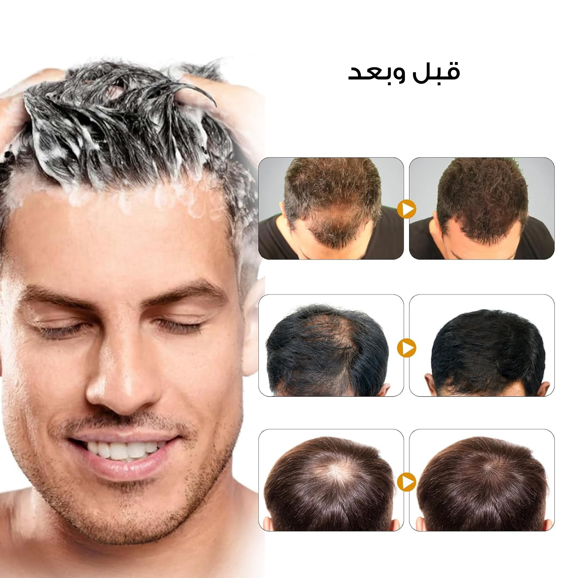 https://media.taager.com/ac6a5c9f-da99-4d84-8f9c-d5fac6f67e82.jpg