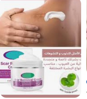 كريم ازالة الندبات