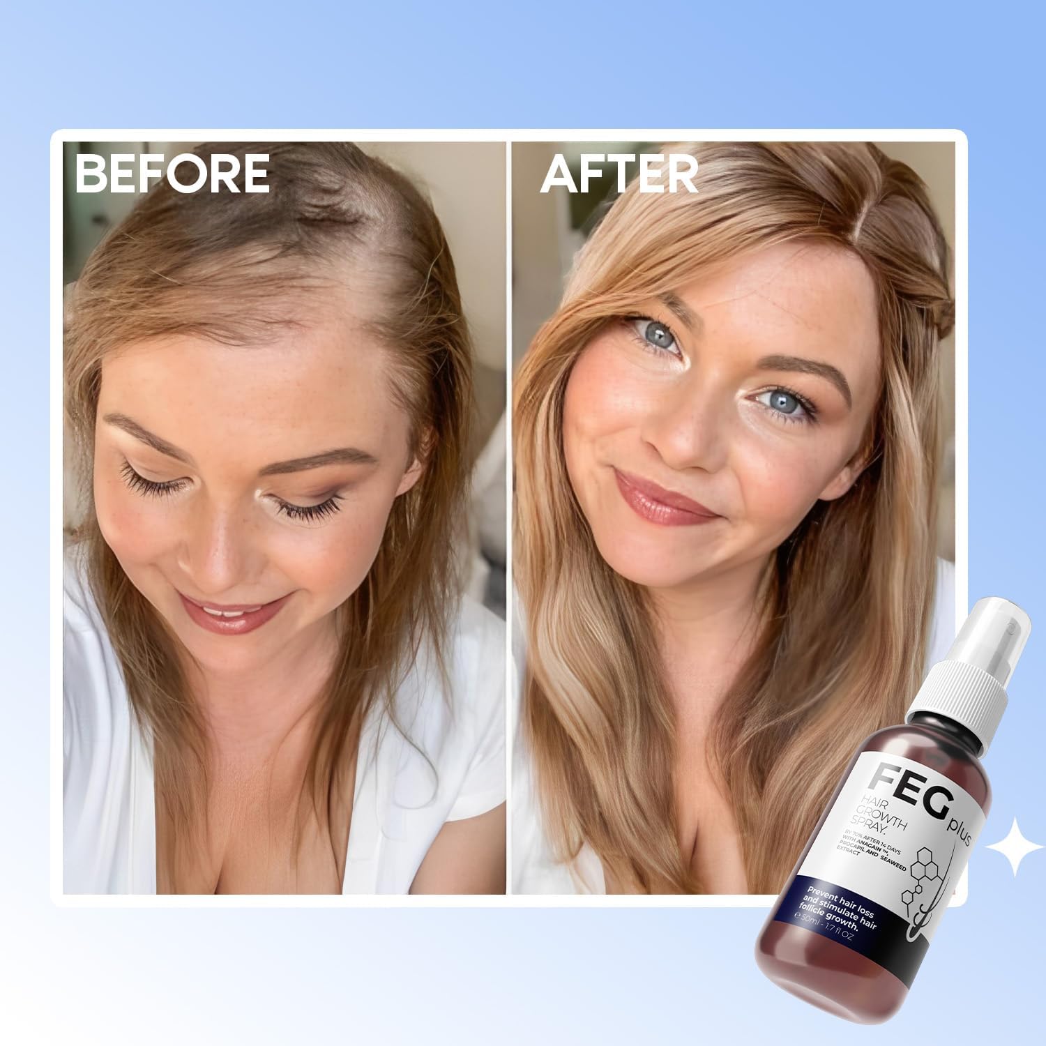 عرض سيرم Blue PePtide + سبراي الشعر FEG 
