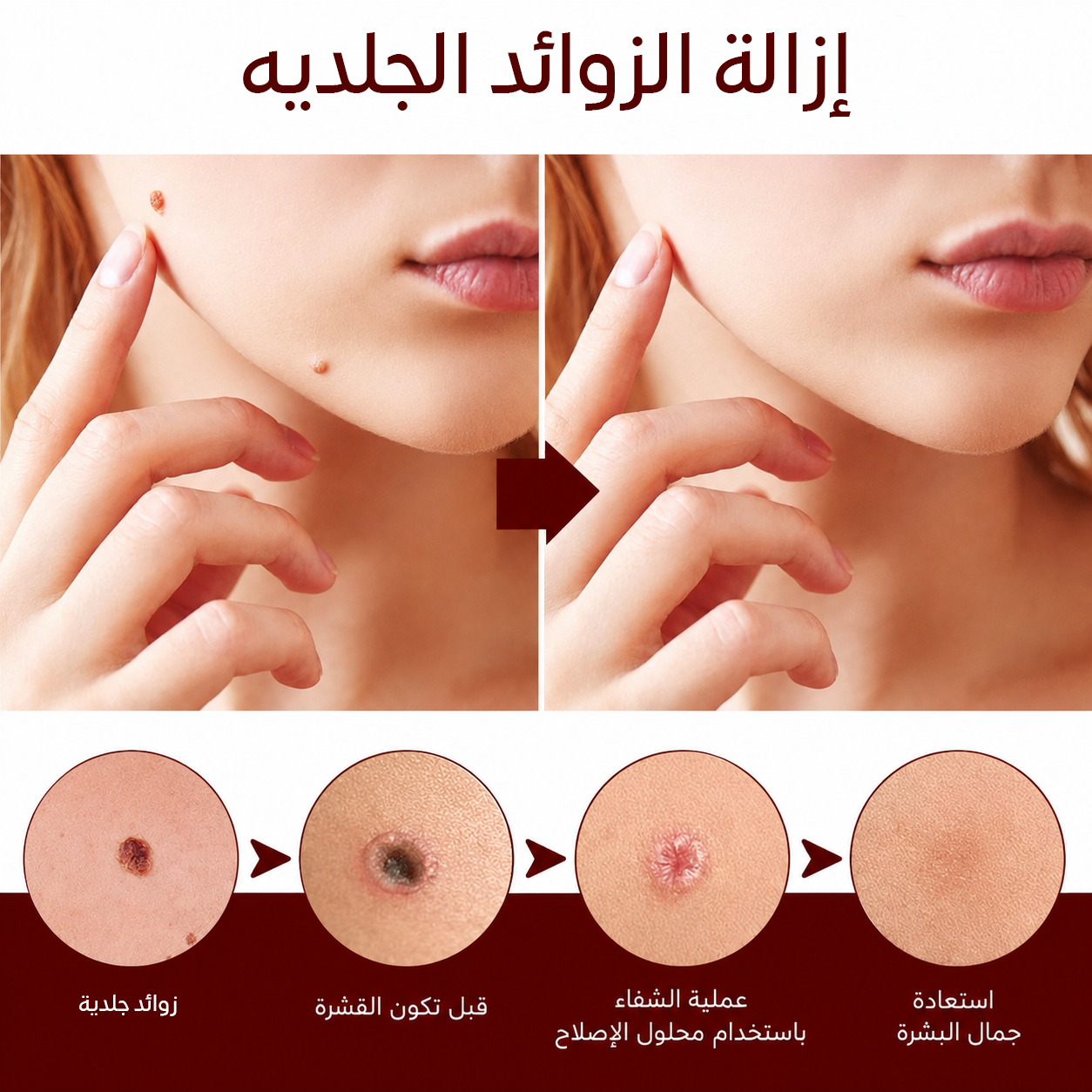 حجم 3 مل يخدمچ لفترة طويلة